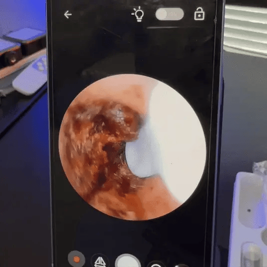 UltraClean ohren, reiniger