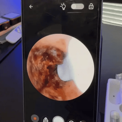 UltraClean ohren, reiniger